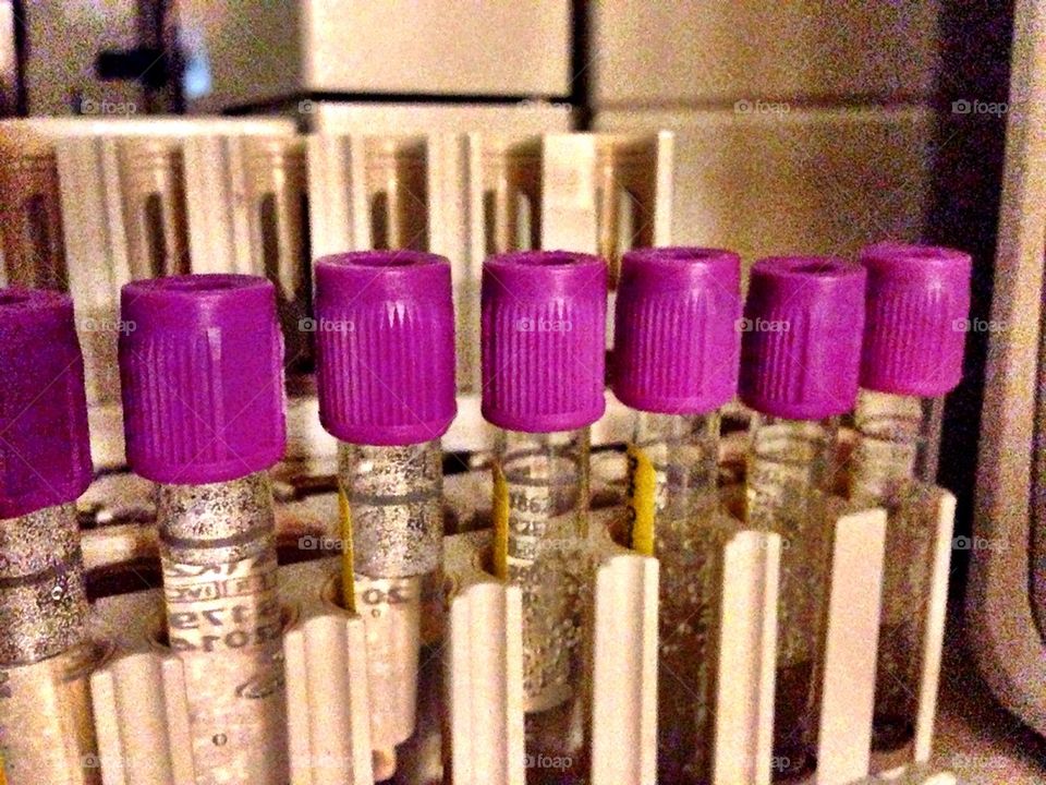Blood sample containers in a lab