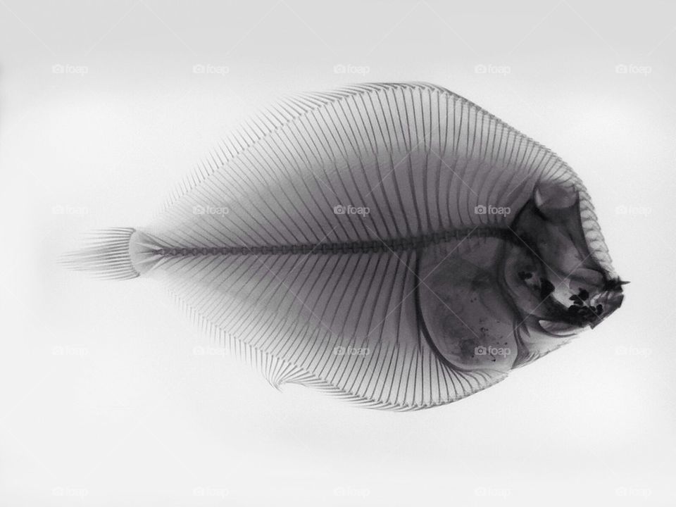 Flounder x-Ray 