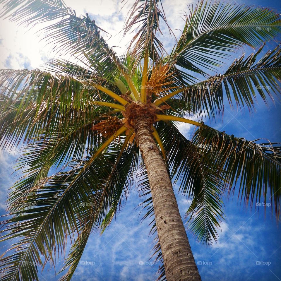 Looking Up Into A Palm Tree Filled Sky