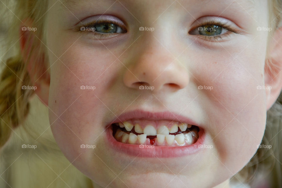 Portrait of girl showing teeth