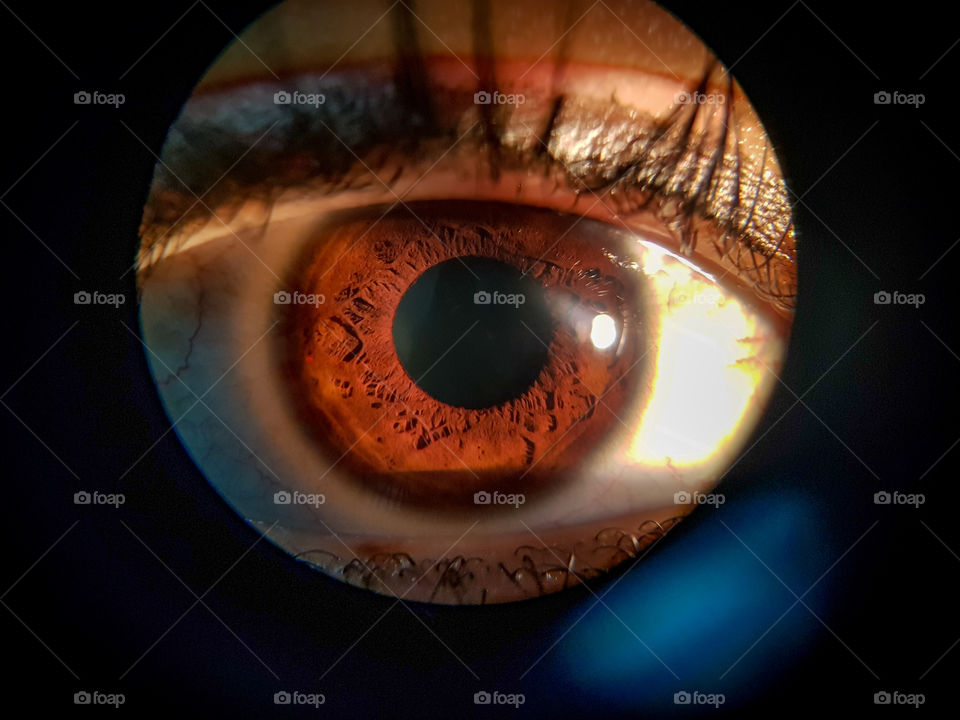 beautiful brown eye close up zoomed with ophthalmoscope light reflecting from it
