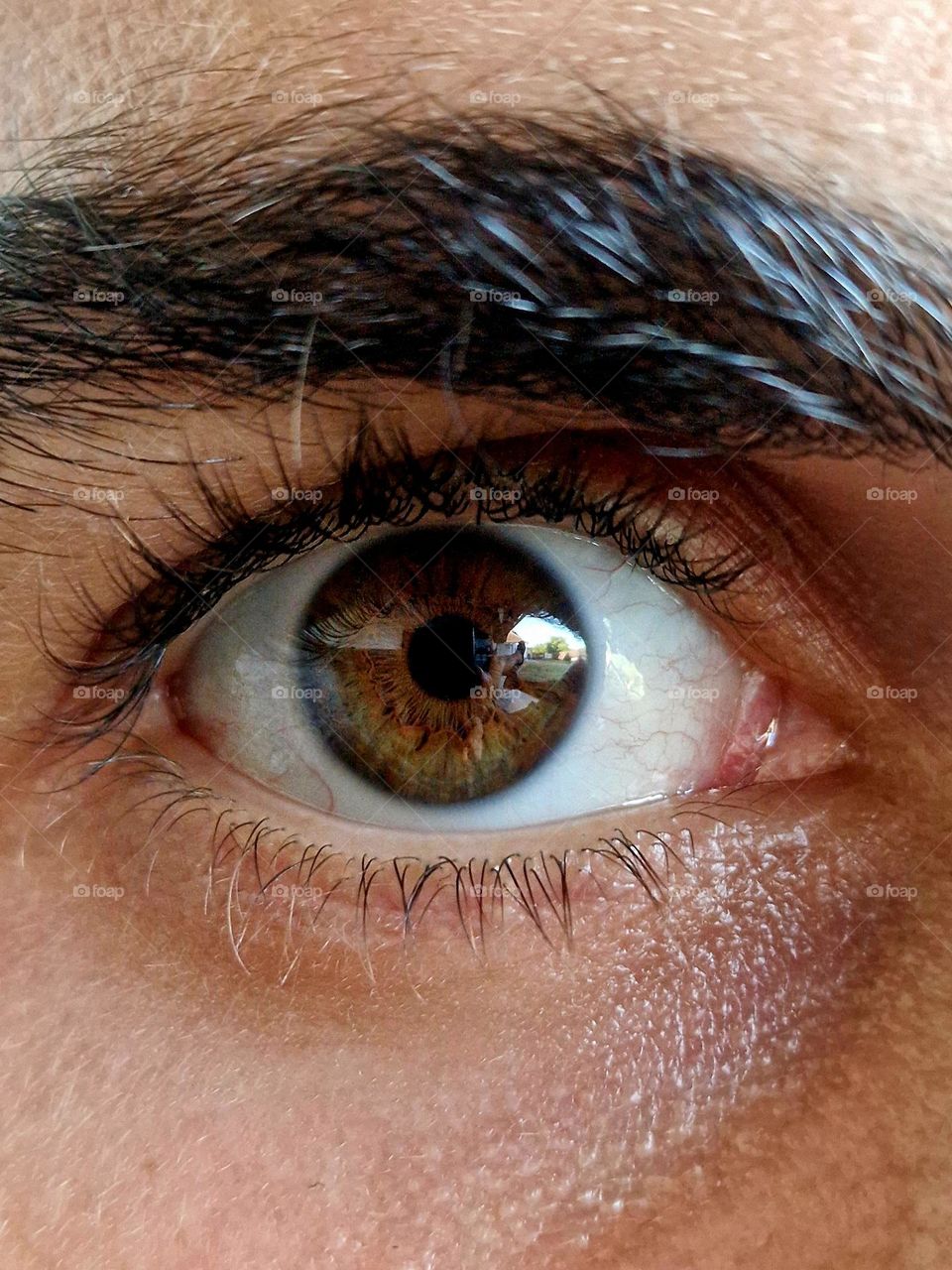 eye