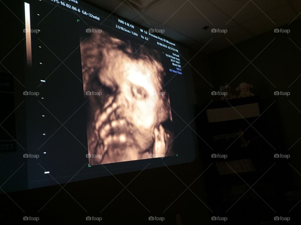 4D Ultrasound baby boy