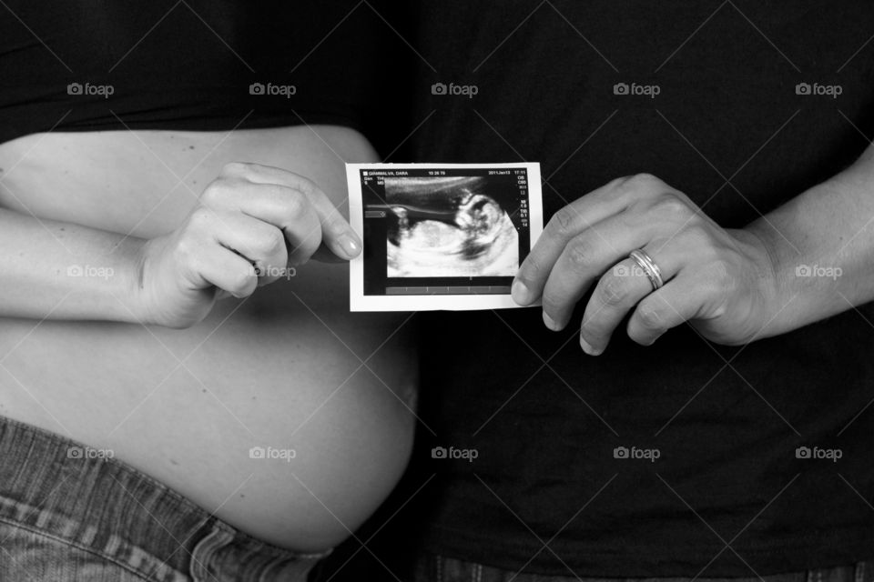 Maternity sonogram picture