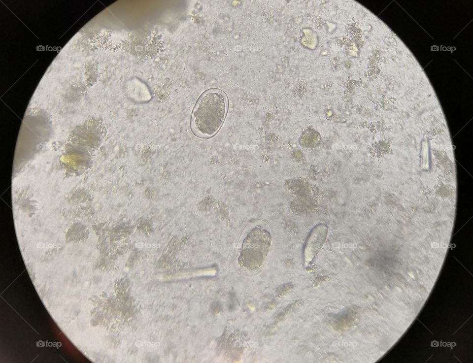 Hookworm Egg