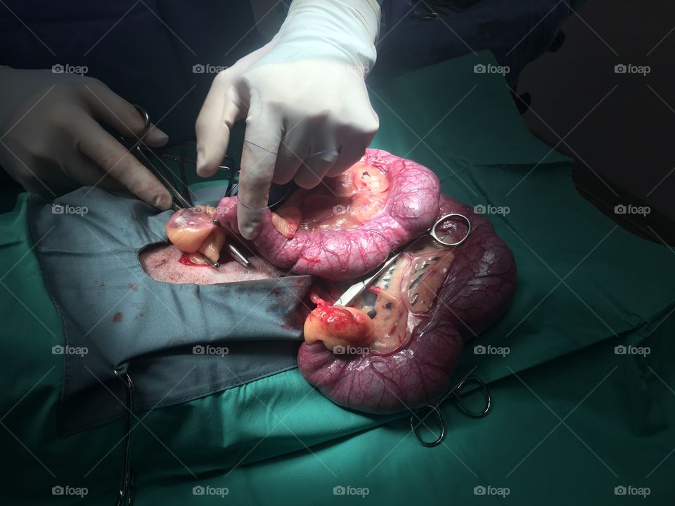 Emergency pyometra surgery at work on a shiba inu. This uterus weighed 3 lbs. 