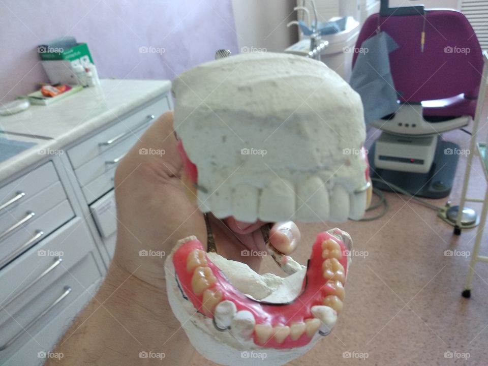Dental dentures