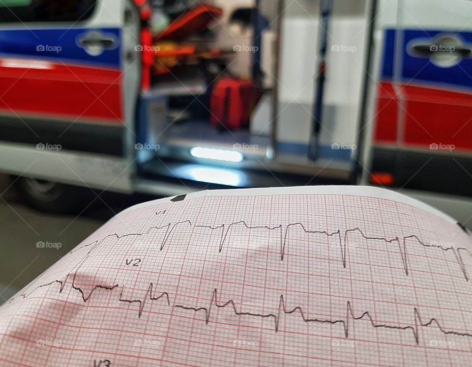 Myocardial infarction in the recording of electrocardiography and in the background an ambulance