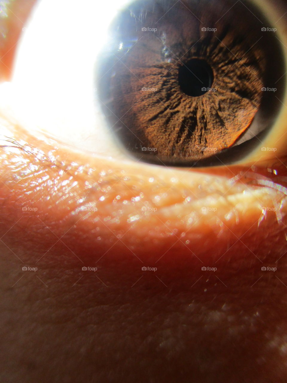 iris eye