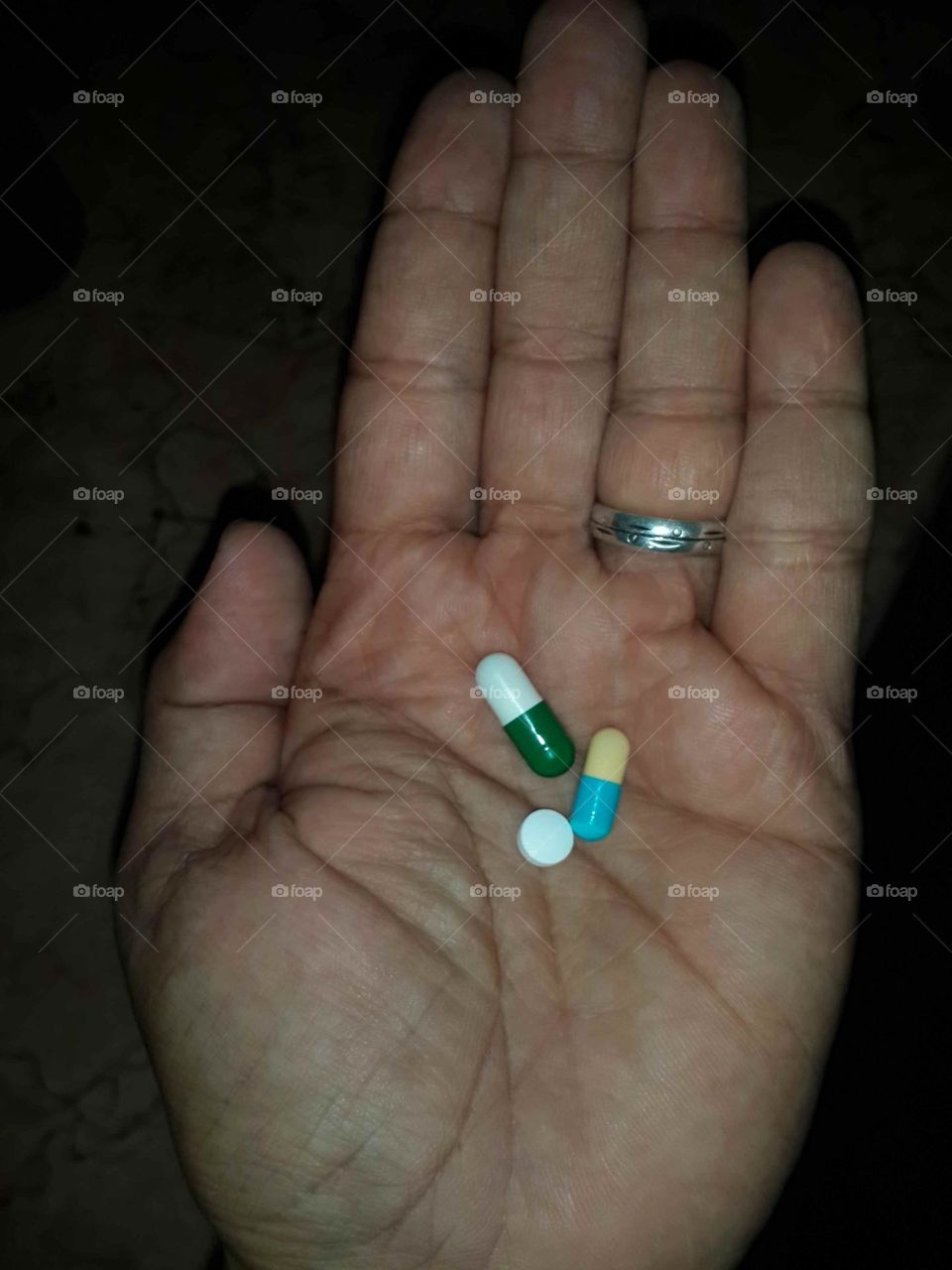 Finally .. I have cervical herniated disc .. it's horrible .. my doctor asked me to stop using mobile and laptop 😢 .. Sorry that I'll rarely browse foap 🙏