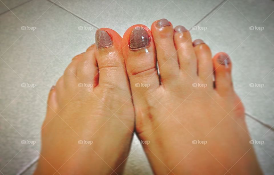 toe nails and care for skin