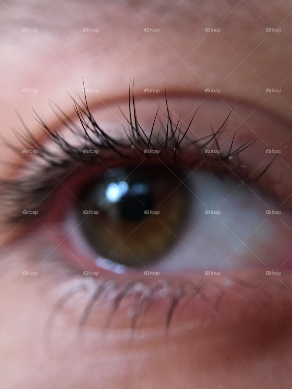 Eye