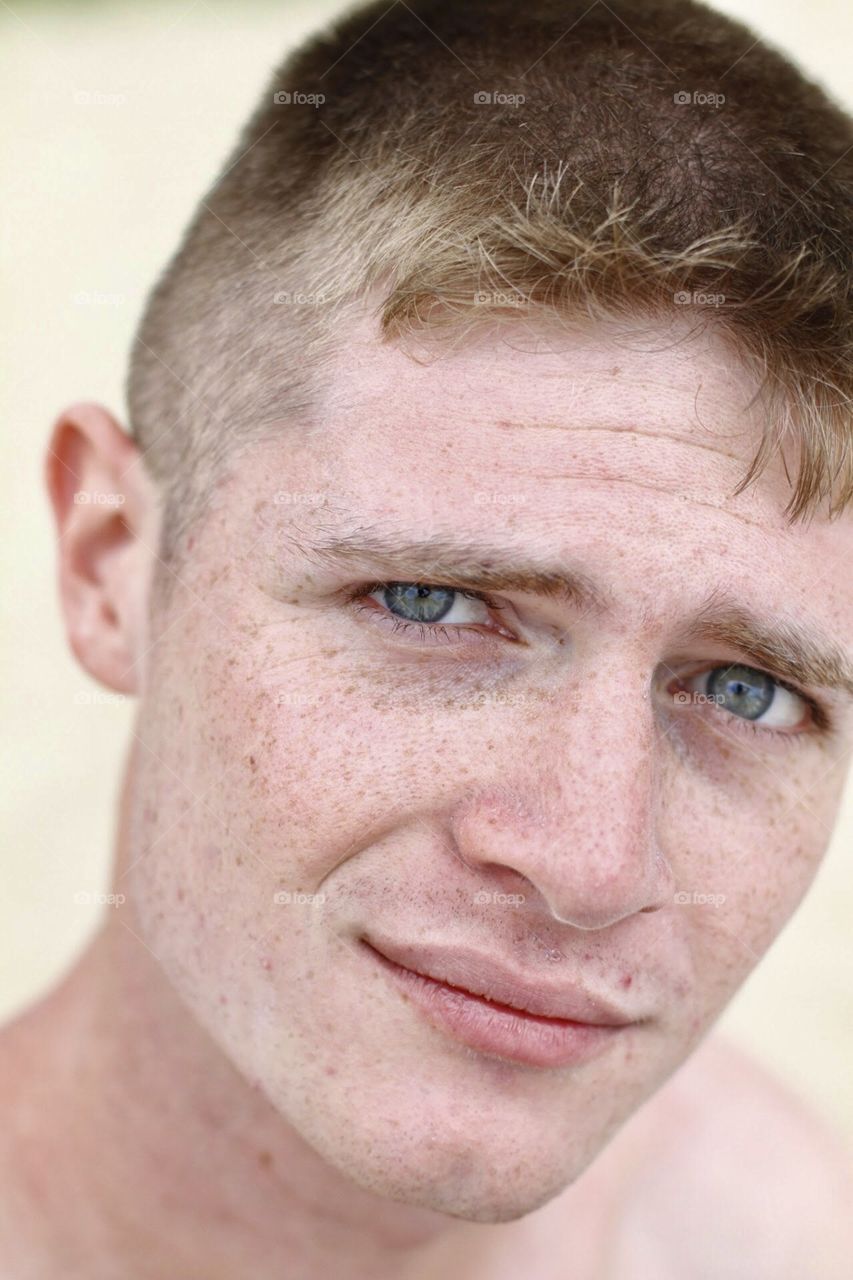 face with freckles