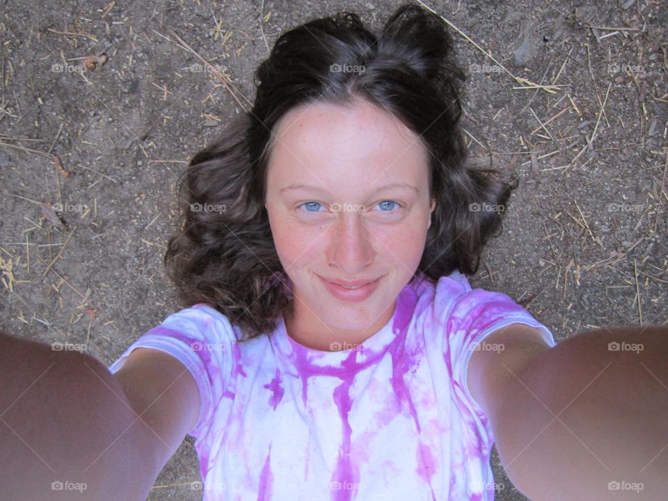 Natural Women.
Me back in the day, sunburned from a camping trip.