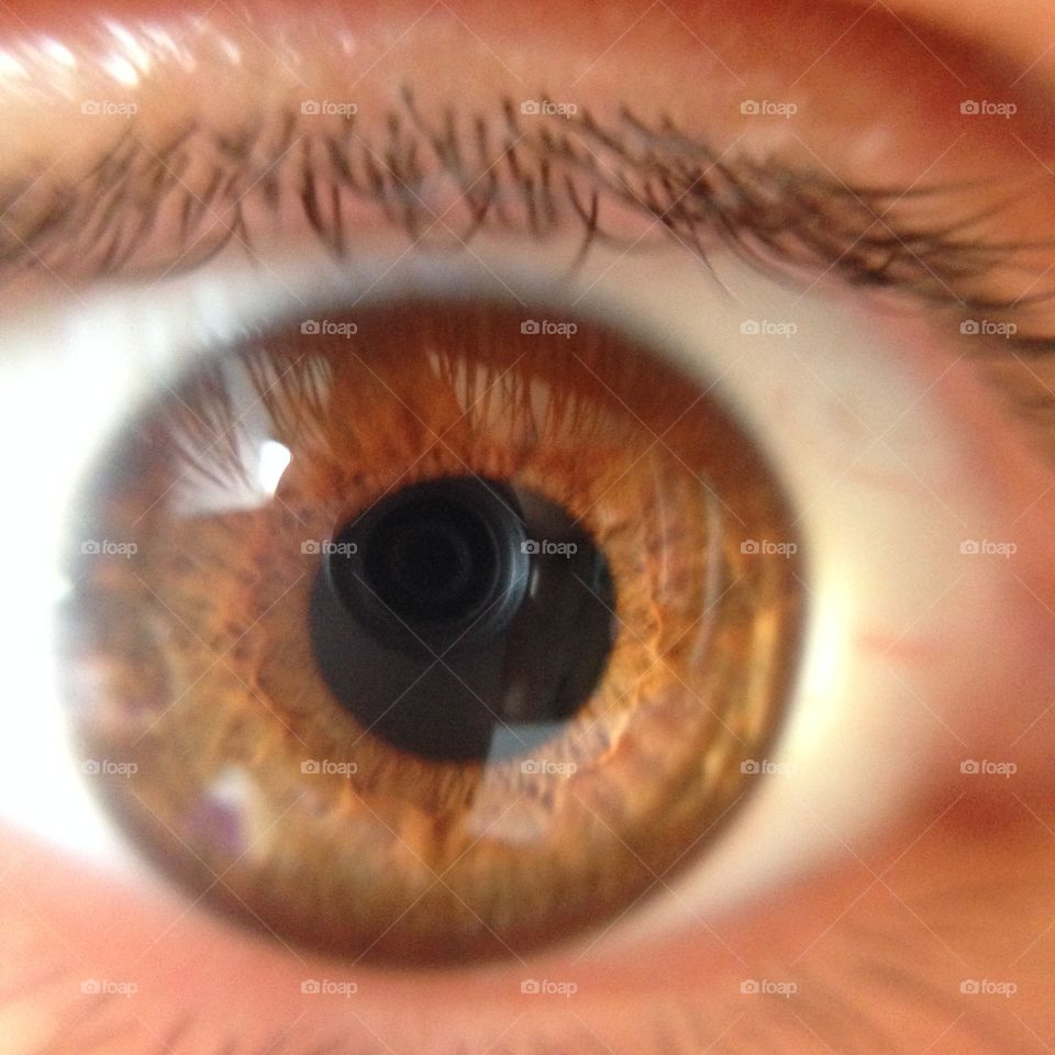 Eye. 