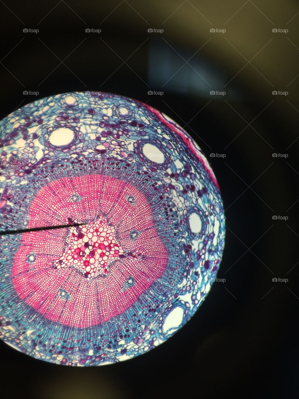 Under the microscope 