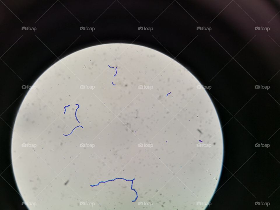 Streptococci