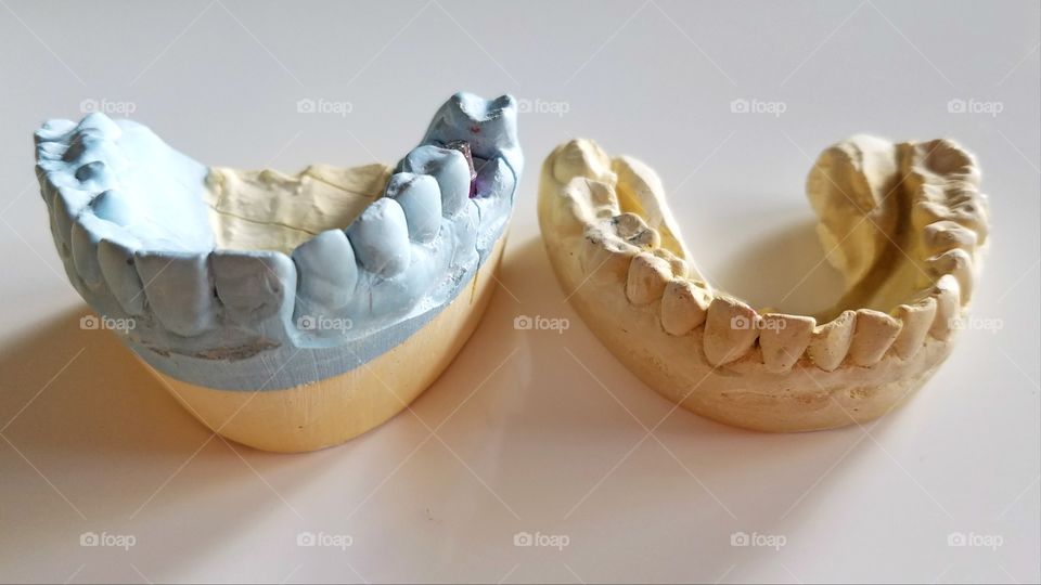 Dental impressions