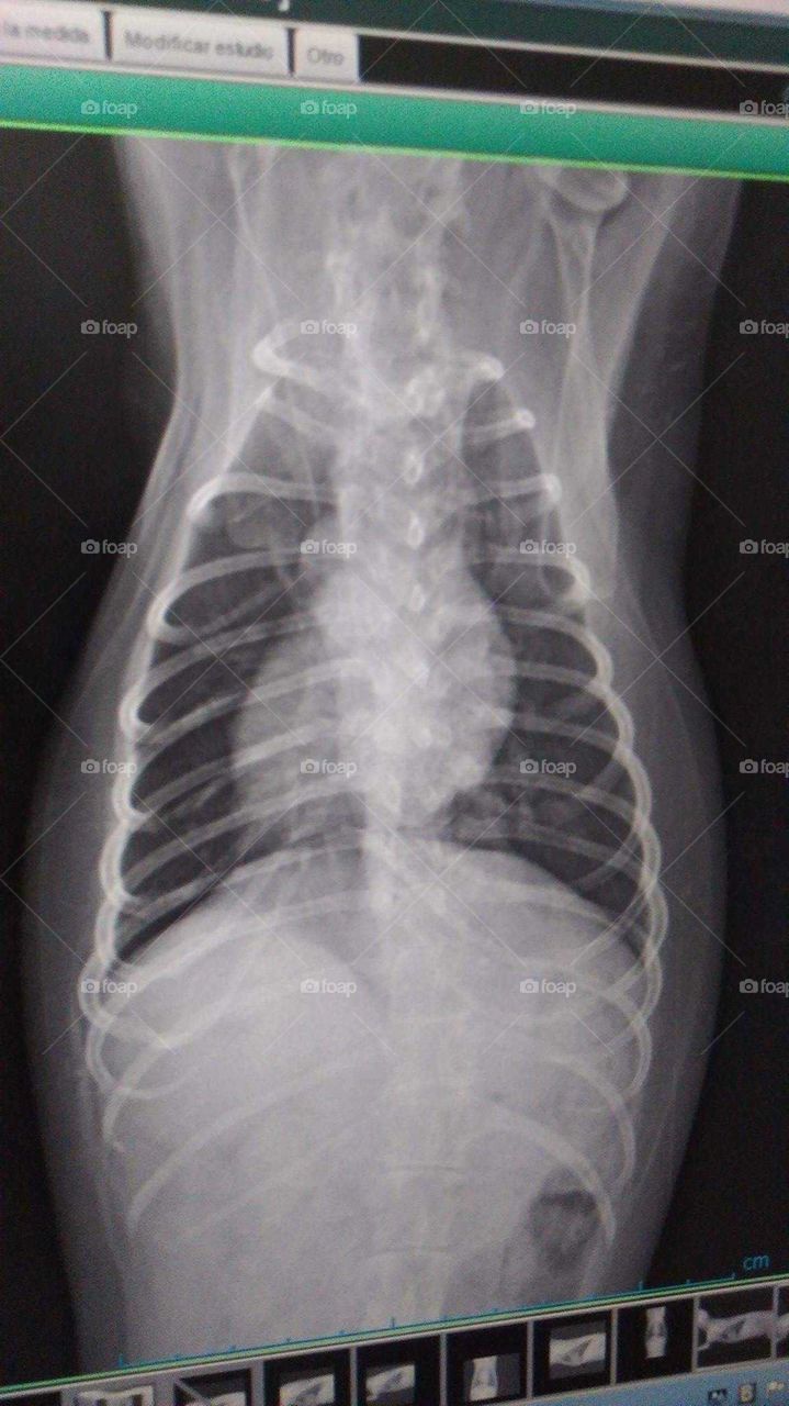 Bone, Diagnosis, Radiography, Frame, Anatomy
