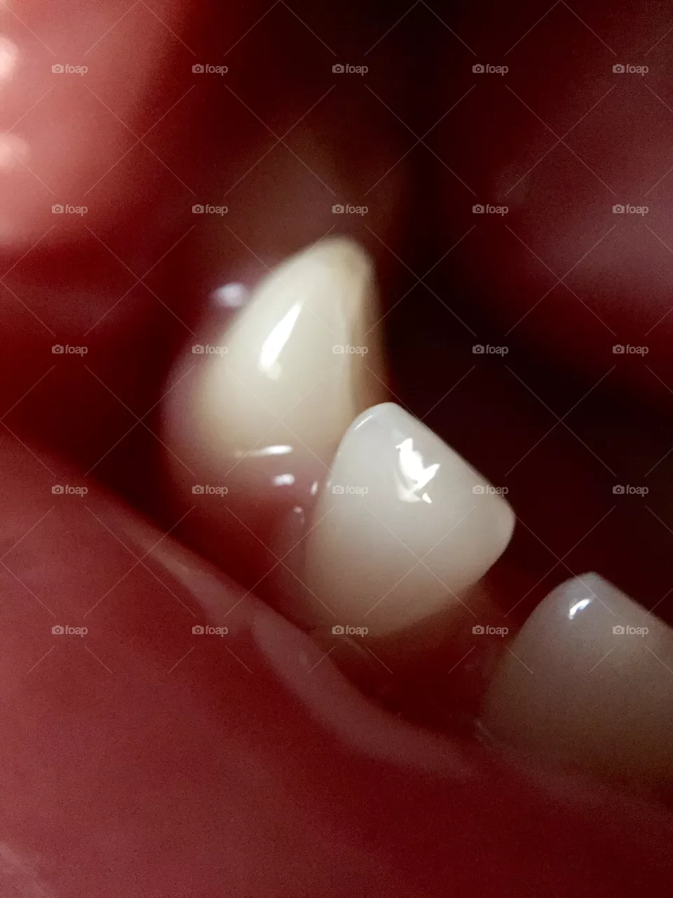 Teeth