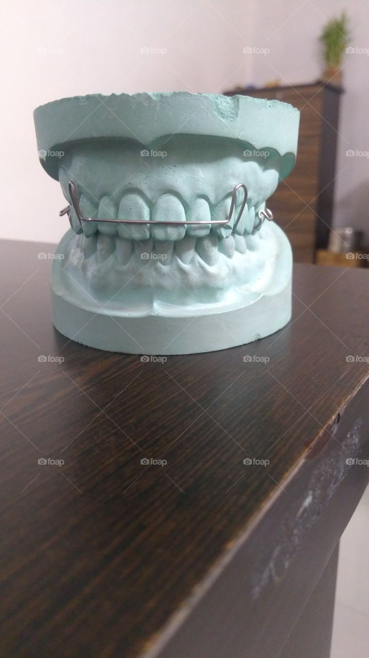 Dentist at work. Denture Model