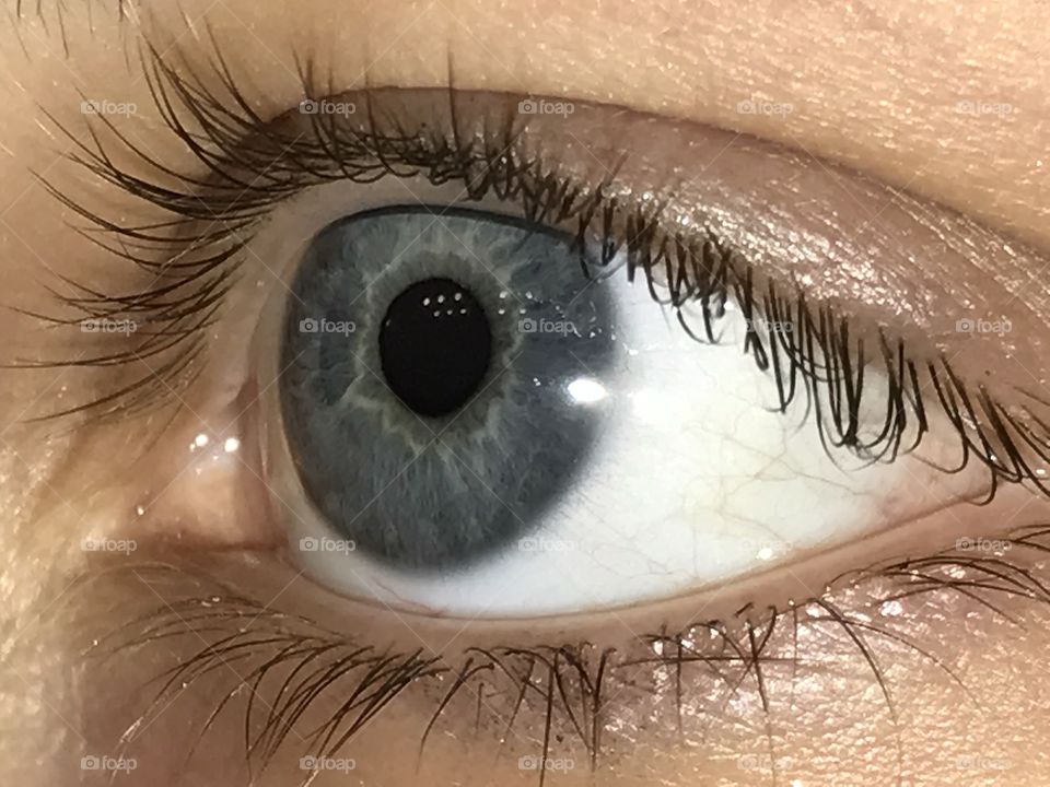 Blue eye 