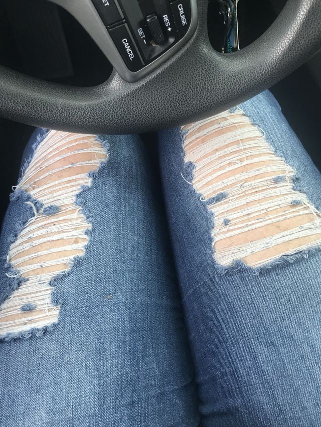 Legs 