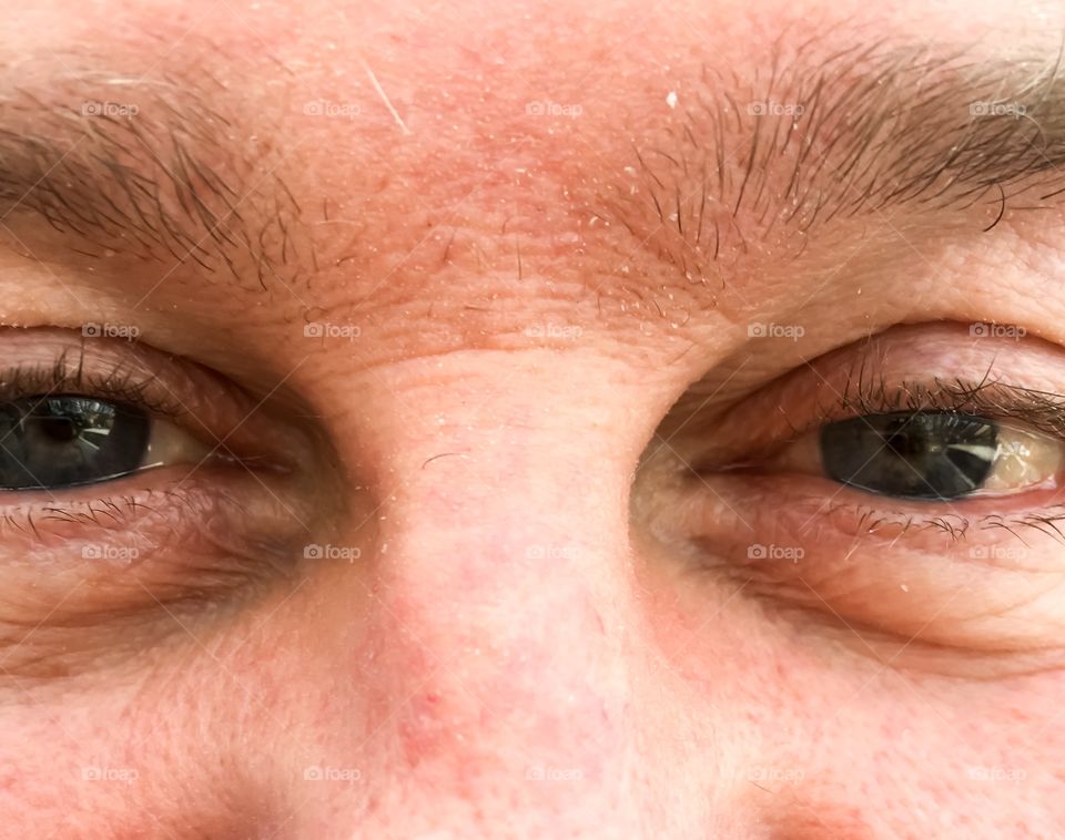 Closeup middle age man's face: eyes and nose, skin