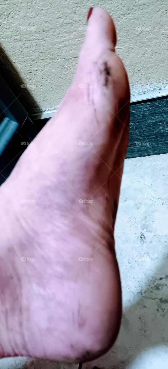 dirty foot
