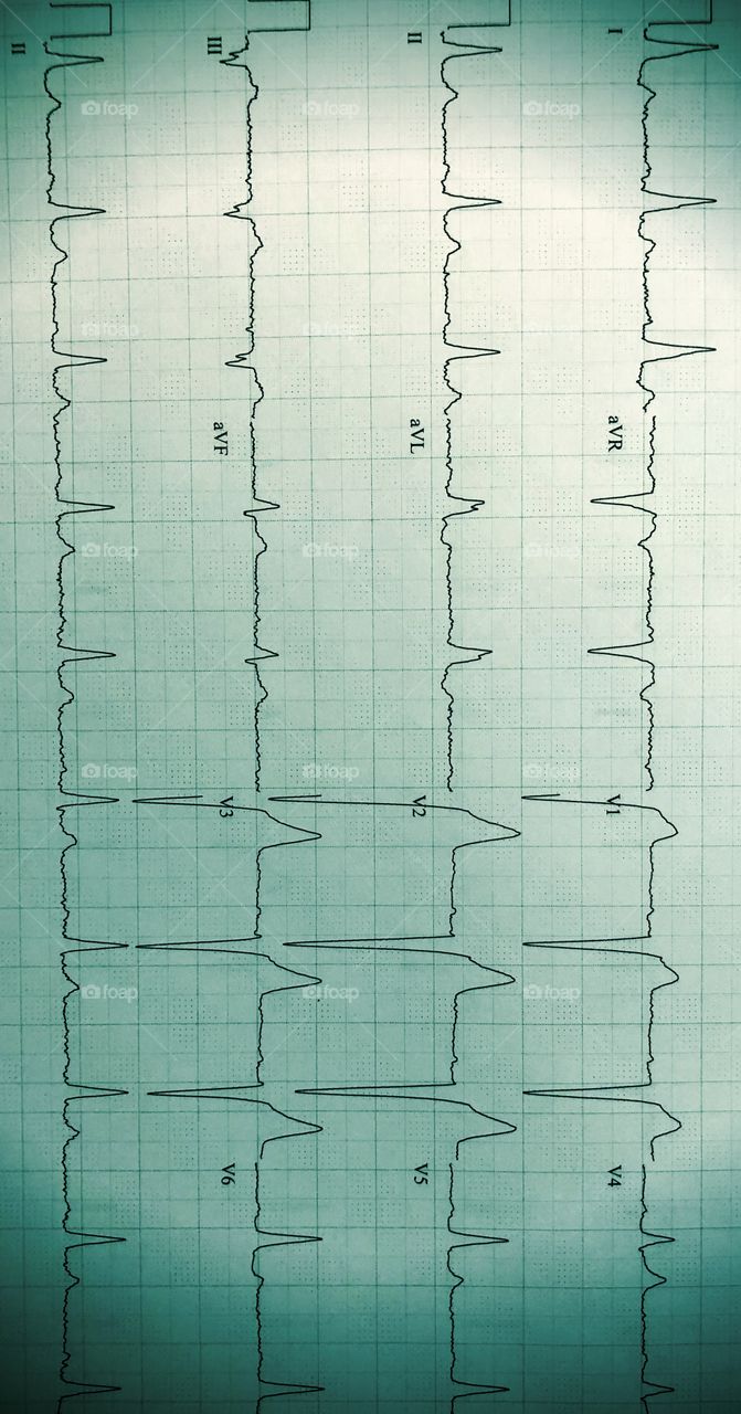 Electrocardiograph 
