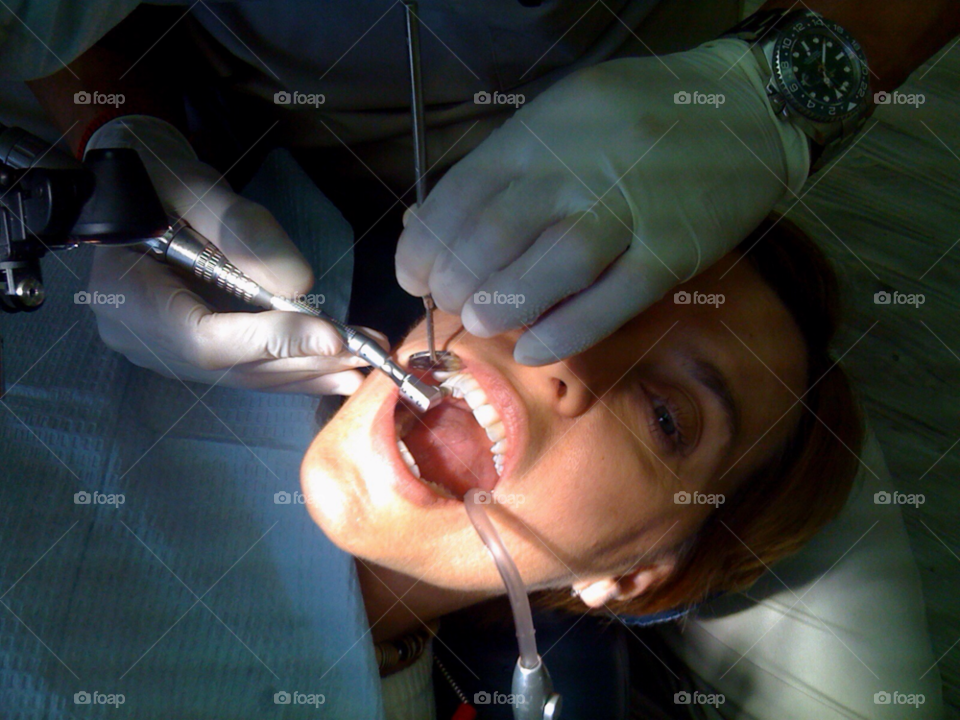 teeth dentist open mouth by jmsilva59