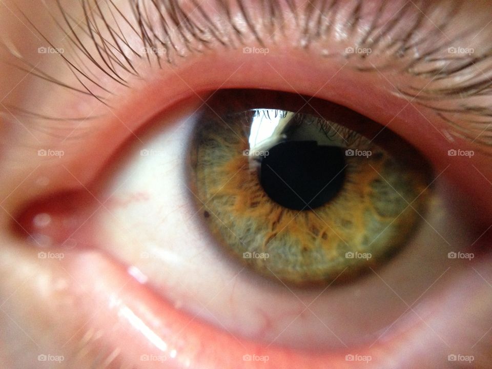 Eye