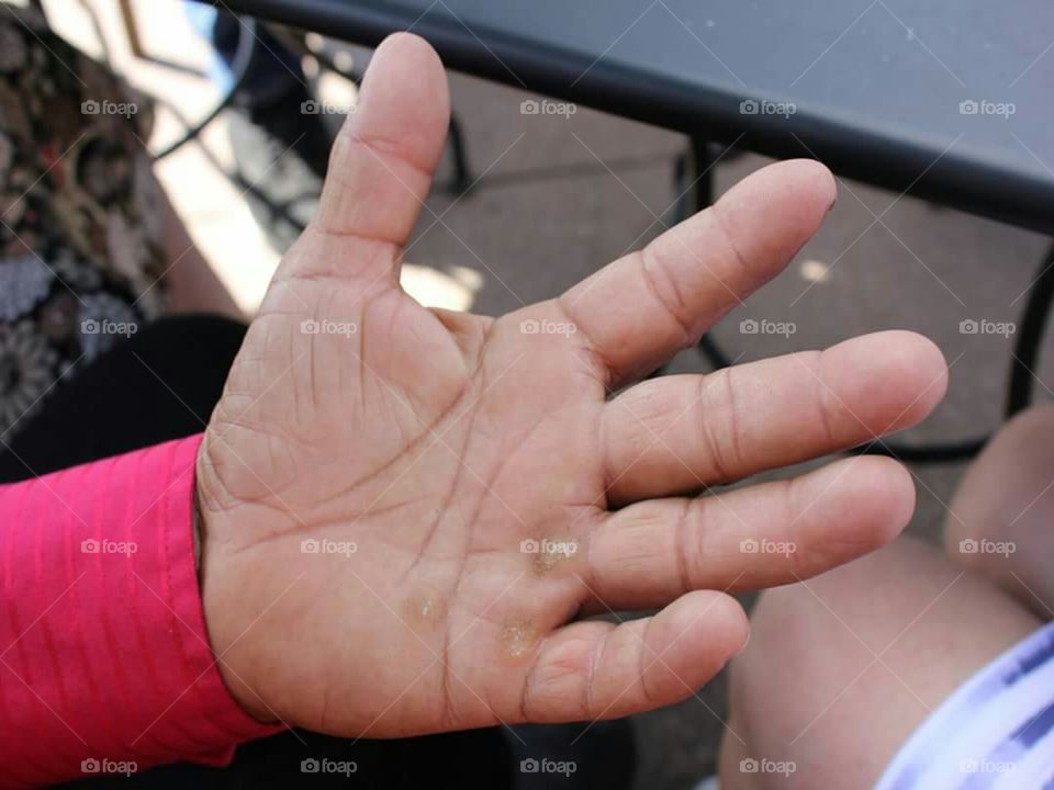 My friend is 62 and he cuts trees down for a living and has been doing it for almost 30 years.