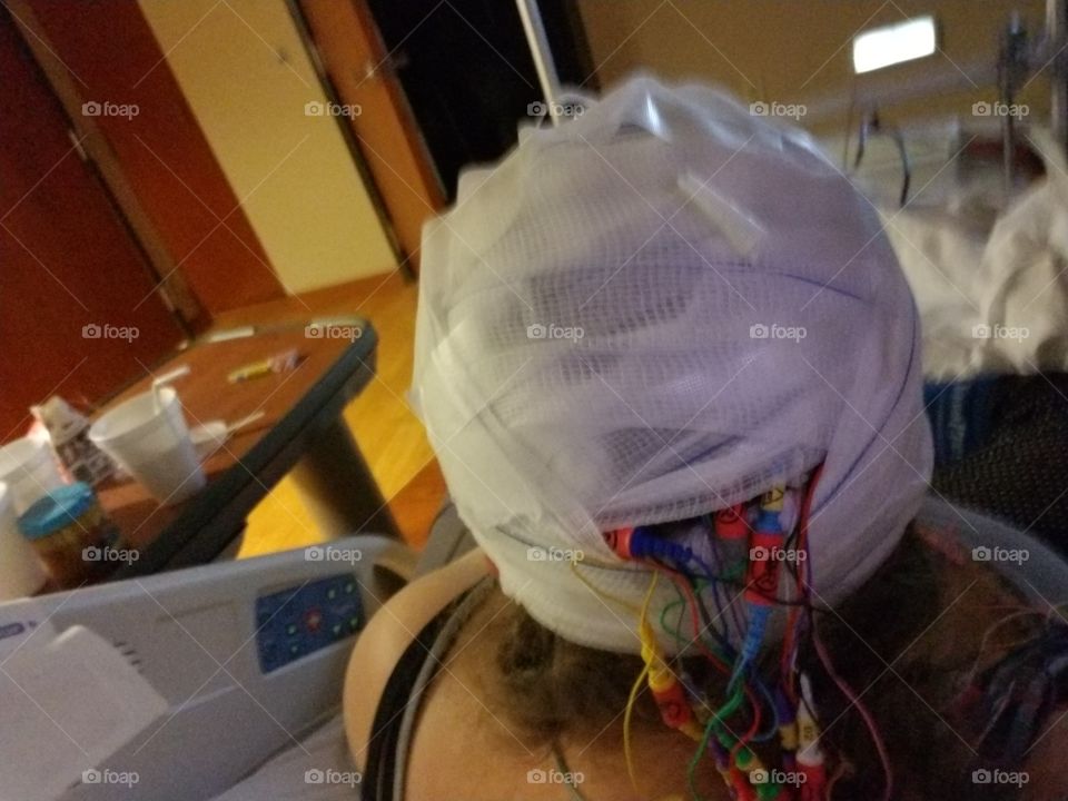 Video EEG