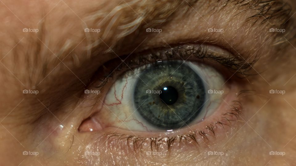 Eye
