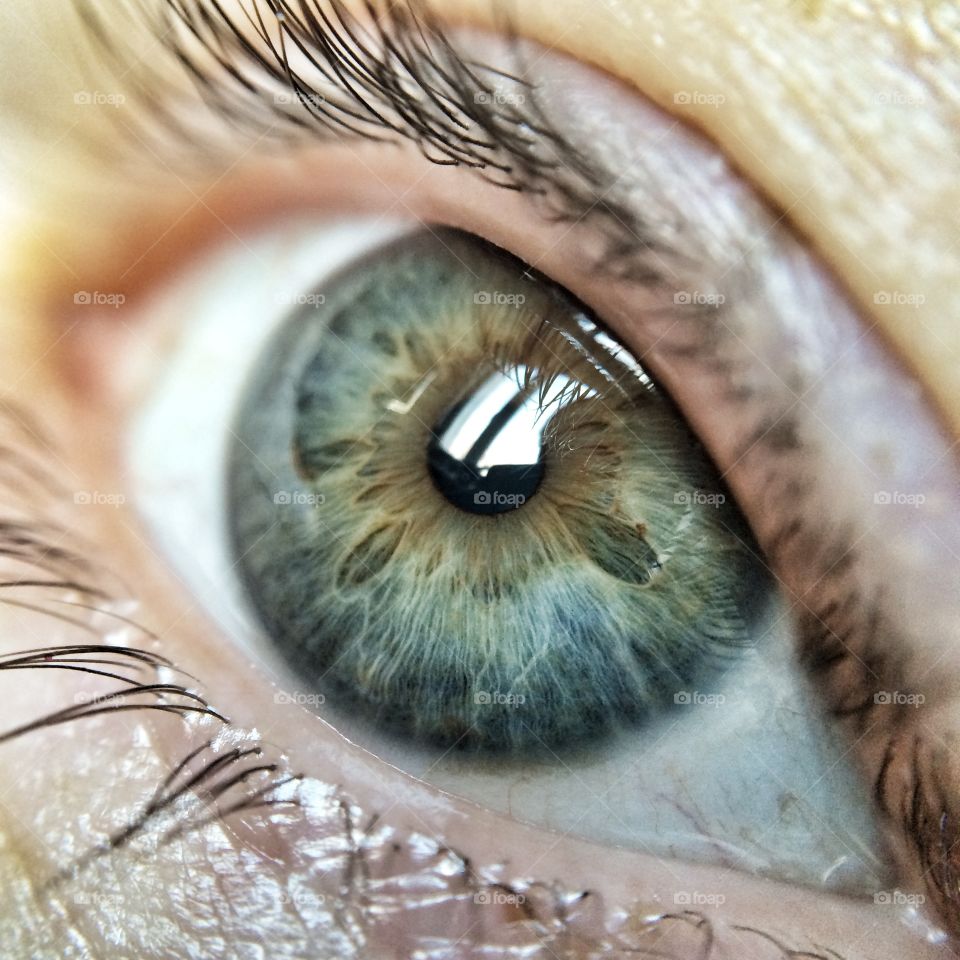 Eye