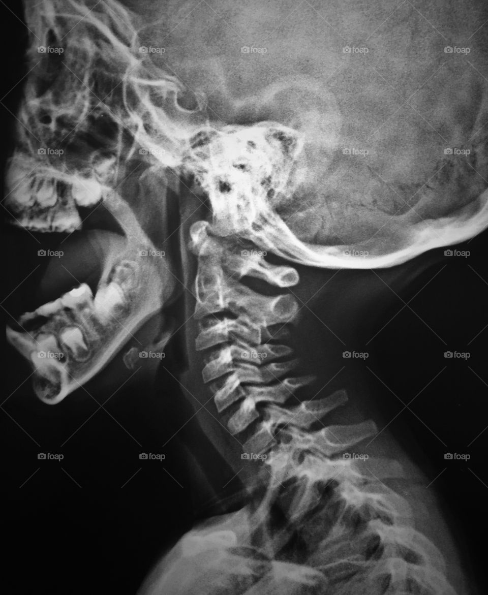 Anatomy x-ray