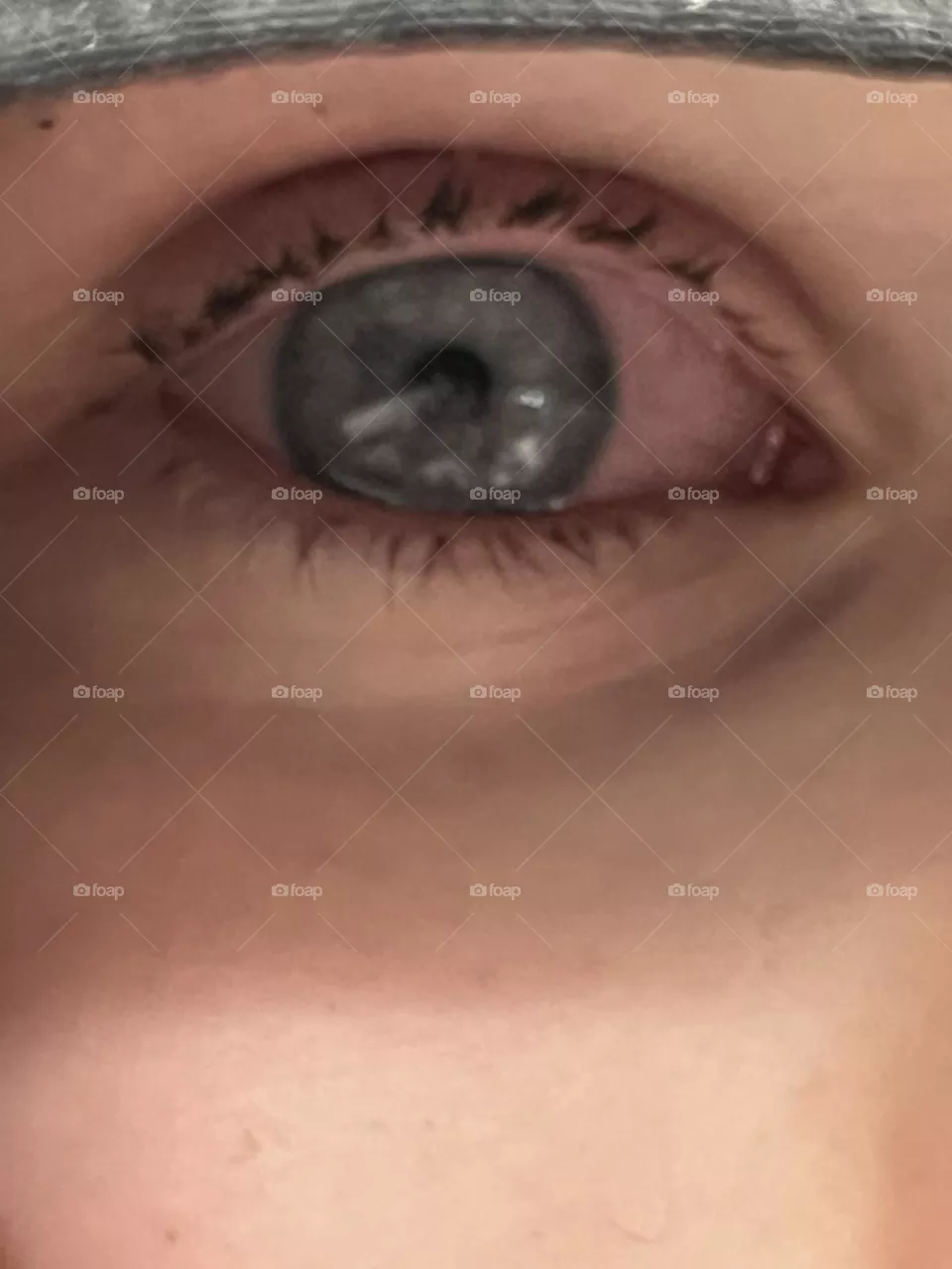Red eyes