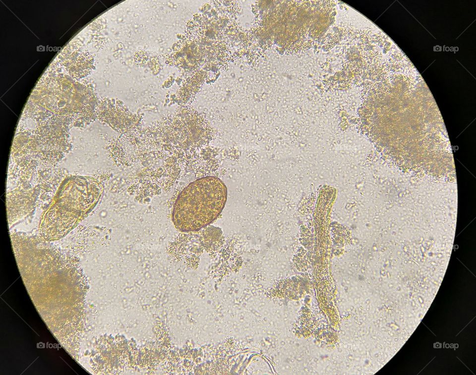 Ascaris Lumbricoides Egg