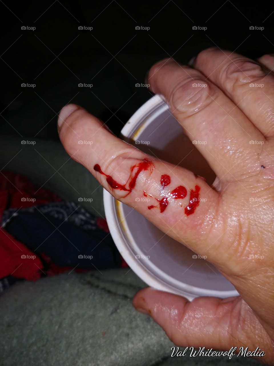 cat bite cup
blood hand finger
