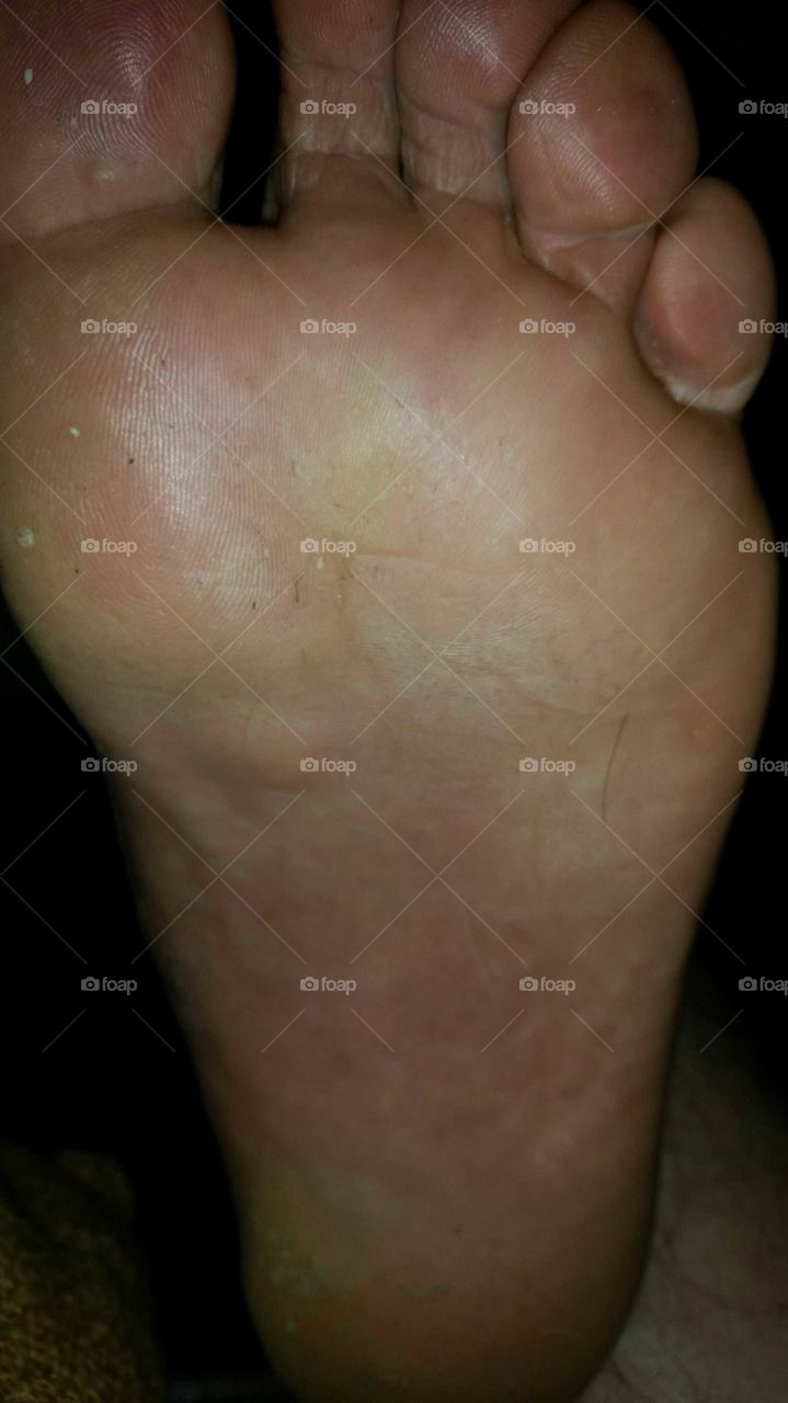 Pain, People, Man, Injury, One