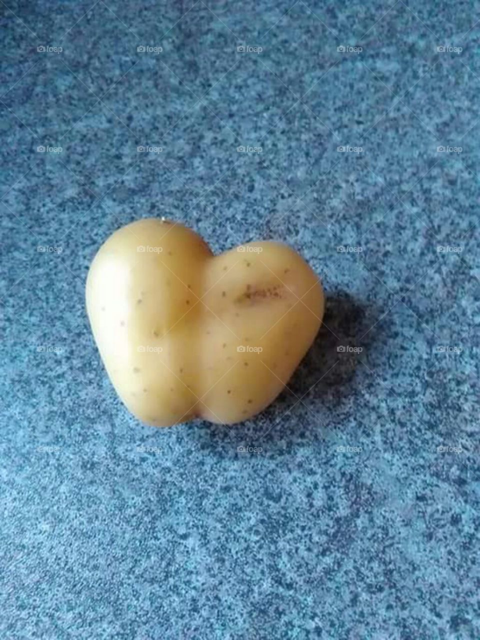 Heart shaped cheeks, maybe?!