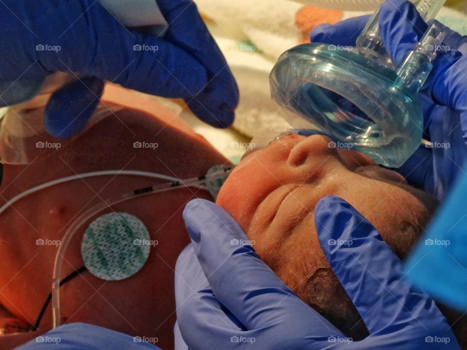Premature Newborn In Intensive Care