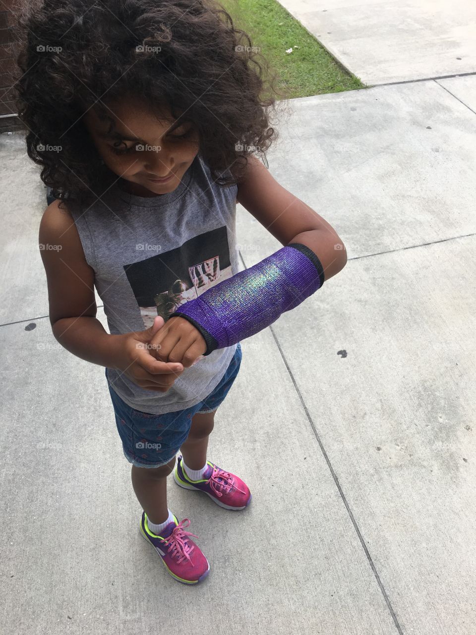 My daughter broke her arm when she fell off her scooter. 