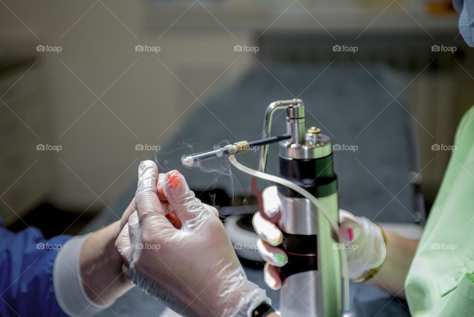 The doctor makes the patient cryotherapy procedure. Close-up of the patient's hand and wounded fingers.