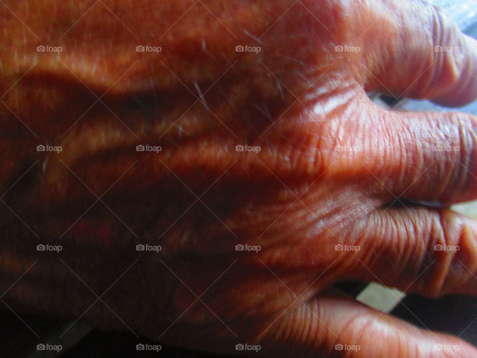 aging hand