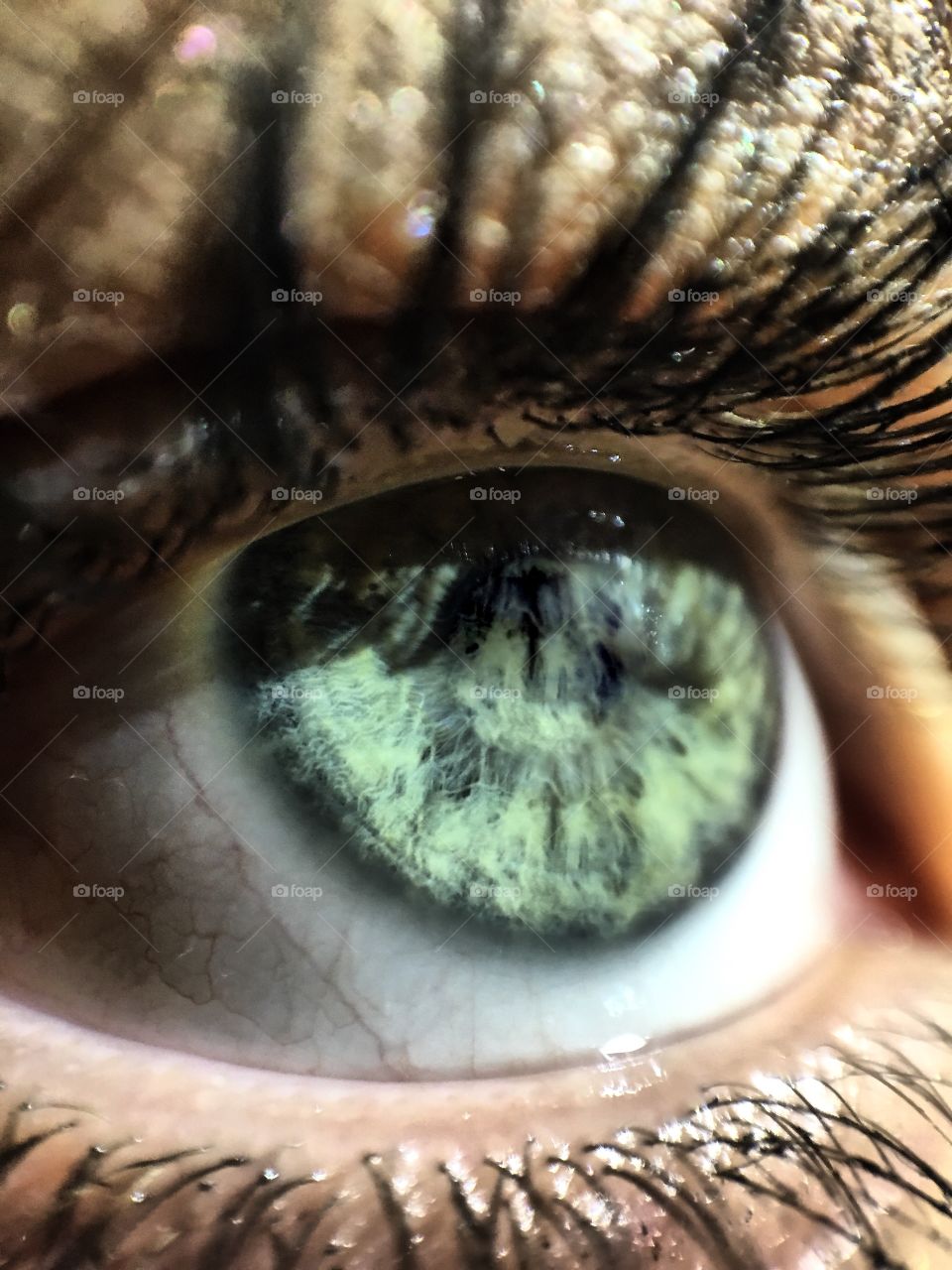 Eye with no pupil 