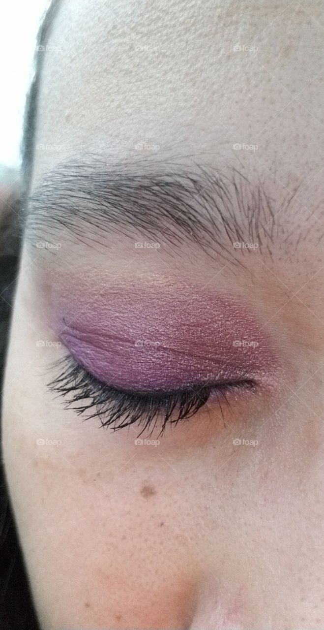 Purple eyelid