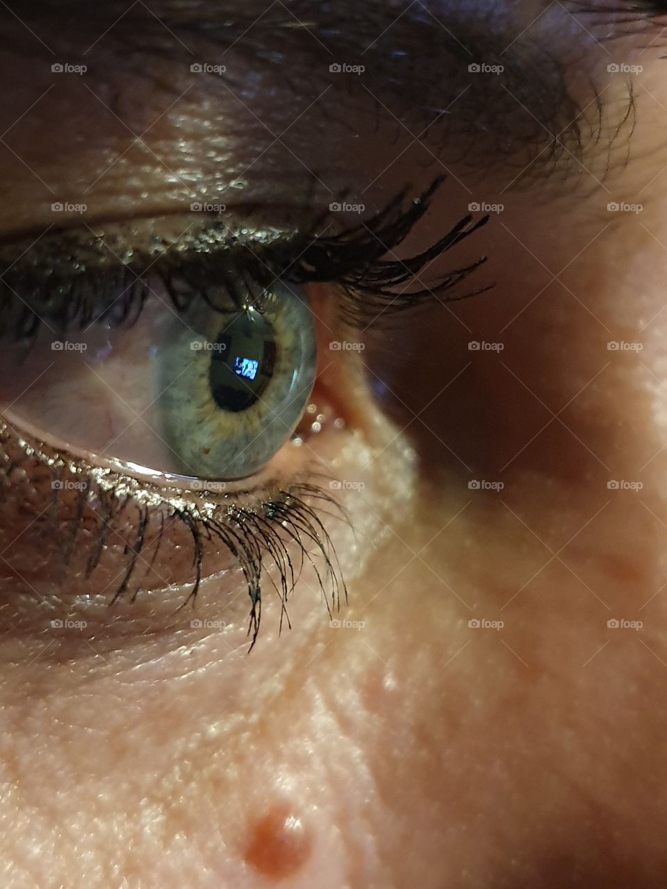 Eye