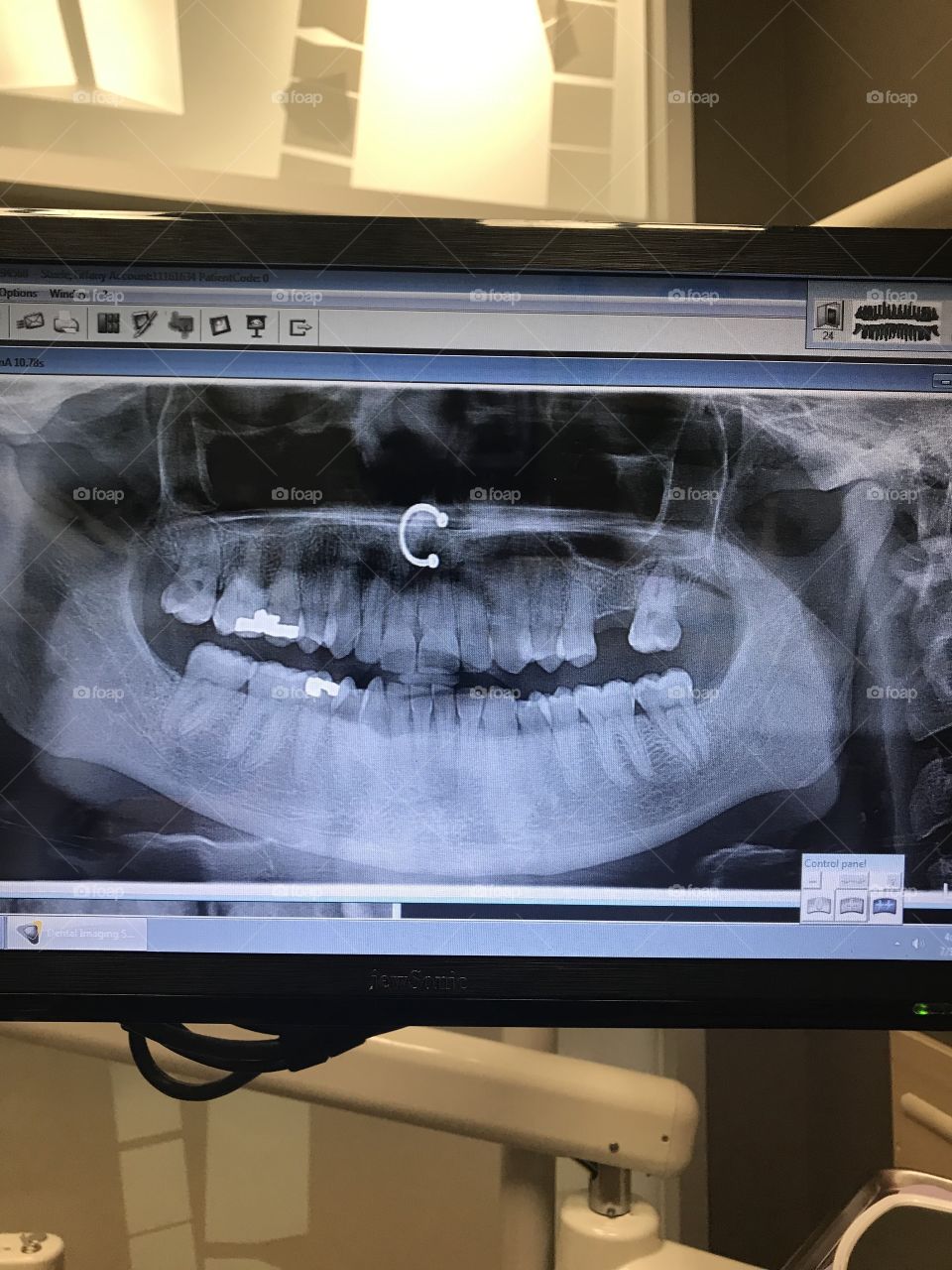 Dental X-ray 
